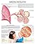 Bronchiolitis e chart: Full illustrated