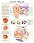 Otitis Media e chart: Full illustrated