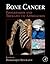 Bone Cancer: Progression and Therapeutic Approaches
