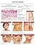 Urticaria e chart: Full illustrated