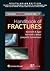 Handbook of Fractures