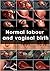 Normal labour and vaginal birth by 7Active studio Normal labour and vaginal birth by 7Active studio