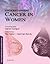 Understanding Cancer in Wom...