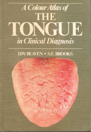 A Colour Atlas of the Tongue in Clinical Diagnosis (Hardcover)