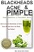 BLACKHEADS, ACNE & PIMPLE: Blackheads, Acne, Pimple home remedies & treatment book: How to remove Blackheads on Nose, Acne diet, Acne causes, Acne remedies ... ACNE TREATMENT, DIET, CURE BOOK 1)