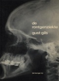 De röntgenziekte (ebook)