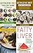 Ketogenic Collection: Box Set (4 in 1): The Utimate Ketogenic Diet Guides & All About Fatty Liver