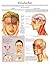 Headaches e chart: Full illustrated