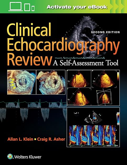 Clinical Echocardiography Review