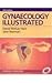 Gynecology Illustrated 5E by Hart Gynecology Illustrated 5E by Hart