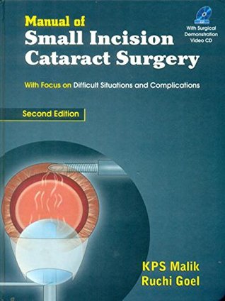 Manual of Small Incision Cataract Surgery (Hardcover)