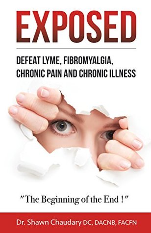 Exposed: Defeat Lyme Disease, Fibromyalgia, Chronic Pain, and Chronic Illness: The Beginning of the End! (Kindle Edition)