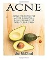 Acne: Acne Treatment: Acne Removal: Acne Remedies For Clear Skin (Acne Skin Care Treatments From Diet & Medical Treatments To All Natural Remedies Including Diet & Scar Removal For Clear Skin)