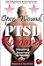 Open Wound, My PTSD Romance: For The Woman Who Loves Him & Does Not Want To Lose Herself in The Process