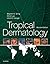 Tropical Dermatology E-Book