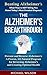 ALZHEIMER'S by Michael Wilson
