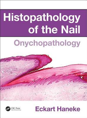 Histopathology of the Nail: Onychopathology