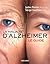 la maladie d'alzheimer, le guide