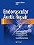 Endovascular Aortic Repair by Gustavo S. Oderich