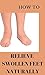 How To Relieve Swollen Feet Naturally