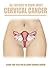 All You Need To Know About Cervical Cancer, a Book That Tells You All About Cervical Cancer