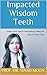 Impacted Wisdom Teeth: A Pa...