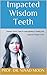 Impacted Wisdom Teeth by Ninad Moon