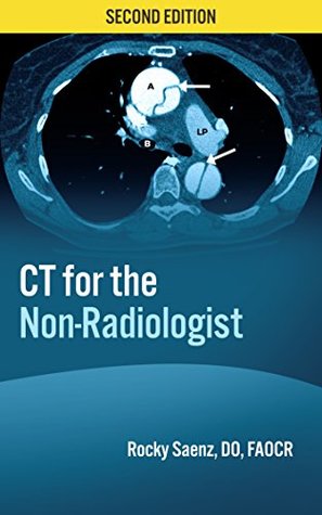 CT for the Non-Radiologist: The Essential CT Study Guide (Kindle Edition)