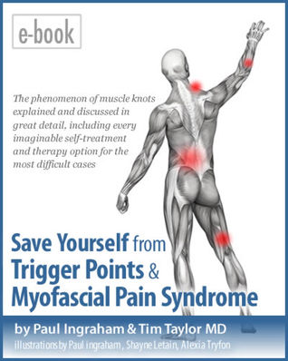 Save Yourself From Trigger Points & Myofascial Pain Syndrome