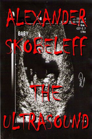 The Ultrasound