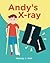 Andy's X-ray by Wendy J. Hall
