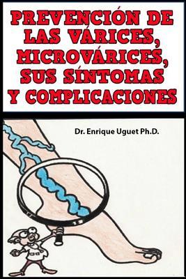 Prevencion de las Varices, Microvarices, Sus sintomas y complicaciones: (B & W) (Spanish Edition)