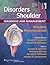 Disorders of the Shoulder by Joseph P. Iannotti