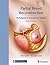 Partial Breast Reconstruction by Albert Losken