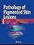 Pathology of Pigmented Skin Lesions