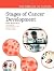 Stages of Cancer Development by Paraic A. Kenny Stages of Cancer Development by Paraic A. Kenny
