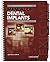 Manual of Dental Implants