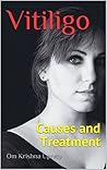 Vitiligo: Causes ...