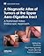 A Diagnostic Atlas of Tumors of the Upper Aero-Digestive Tract: A Transnasal Video Endoscopic Approach