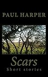 Scars