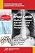 Breast Cancer: Medical Trea...