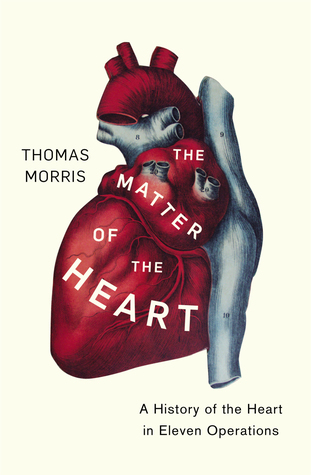The Matter of the Heart: A History of the Heart in Eleven Operations (Kindle Edition)