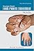 Triorigin Model Four Points Treatment