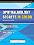 Ophthalmology Secrets in Color