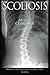 Scoliosis by Michael Chardack