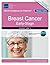 Breast Cancer, Early-Stage