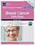 Breast Cancer, Early-Stage by National Comprehensive Canc...