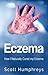 Eczema: How I Naturally Cured my Eczema