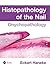 Histopathology of the Nail: Onychopathology