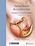 Partial Breast Reconstruction: Techniques in Oncoplastic Surgery